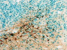 ROSA TH Z-Series 20x